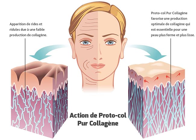 image presentant les effets de protocol pur collagene sur la peau