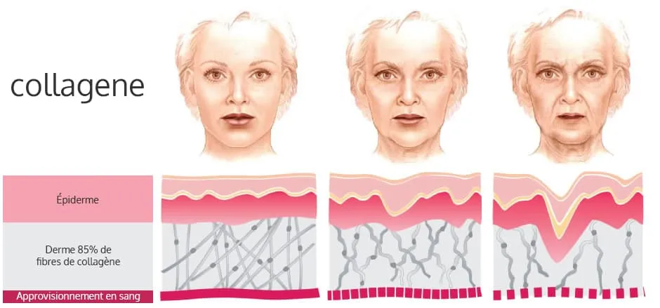 image avec trois visages de femme et les effets du collagene sur l'epiderme