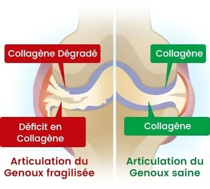 image presentant la difference entre une articulation ayant du collagene degradé et une autre avec du collagene normal