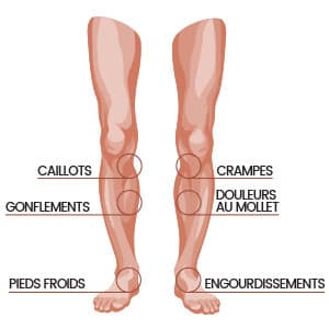 Graphiques des jambes indiquant divers problèmes pouvant survenir dans les jambes