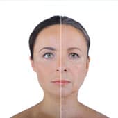 femme blache montrant les effets d'une creme sur la peau de son visage