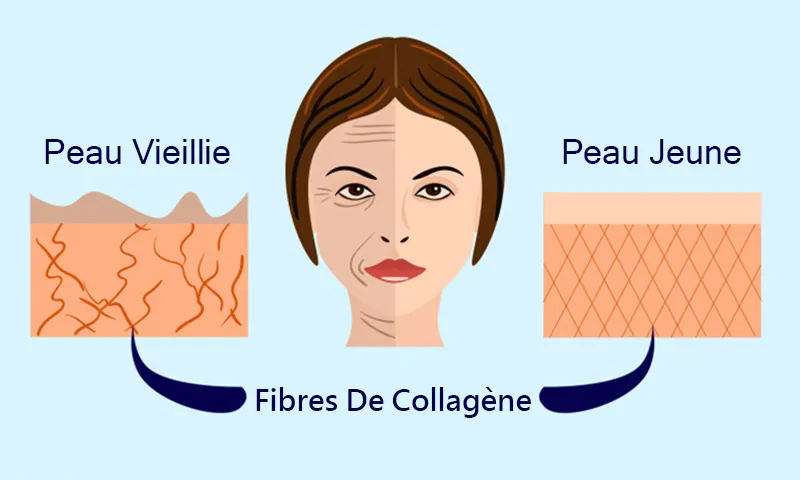 Fibres de collagène - explications sur la présence d'une peau jeune par rapport à une peau âgée