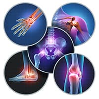 The role of joints