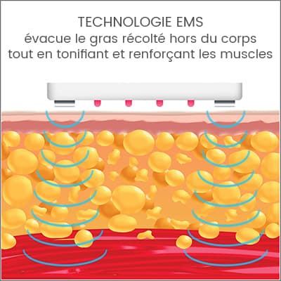 silk'n lipo technologie ems silk'n lipo technologie ems