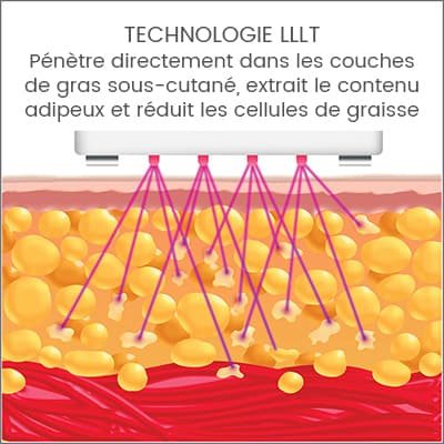 silk'n lipo technologie lllt silk'n lipo technologie lllt